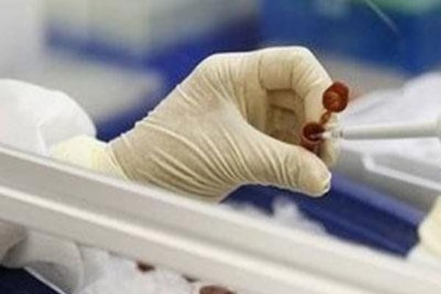 В Киеве мужчина умер от малярии