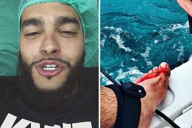 Тимати пришлось лечь под нож хирурга из-за укуса барракуды