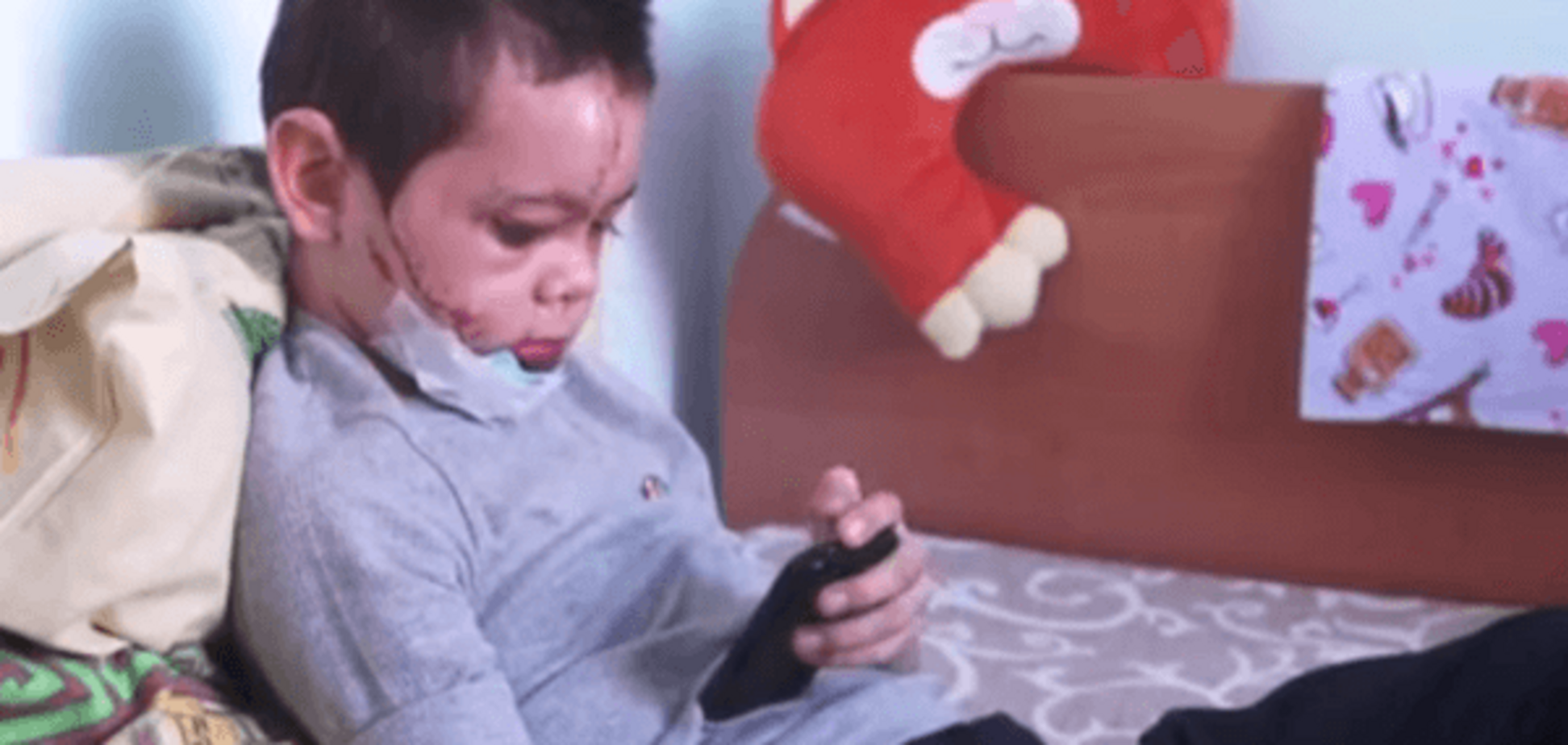 Без ног и с одной рукой: последствия игры детей с РПГ на Донбассе шокируют. Видеофакт