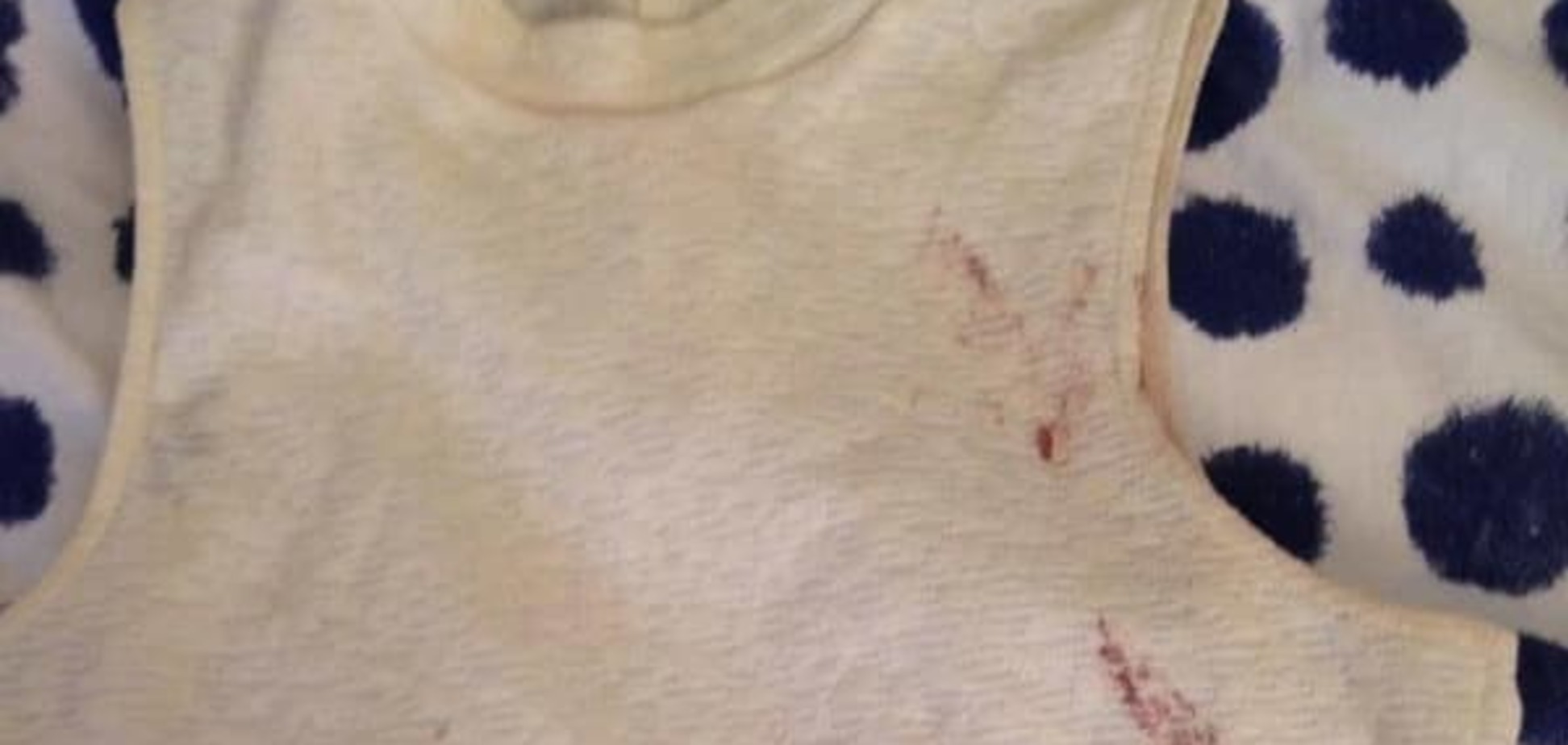 'Мы теперь обязаны стать лучшими людьми': письмо выжившей в парижском теракте девушки прочли 2,5 млн человек