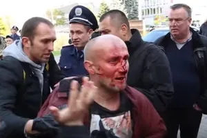 Александру Кравчуку в кровь разбили лицо