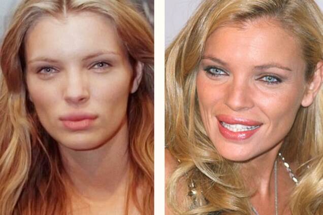 Жертвы пластики: модели, которых не узнать после операций