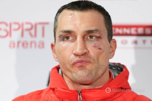 Кличко до сих пор в шоке от боя с Фьюри