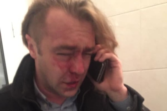 'Свободовца' Мирошниченко избил любовник бывшей жены