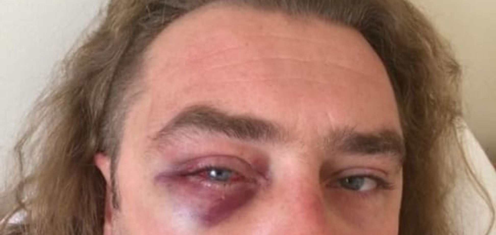 Избиение Мирошниченко: 'обидчик' намерен подать на него в суд