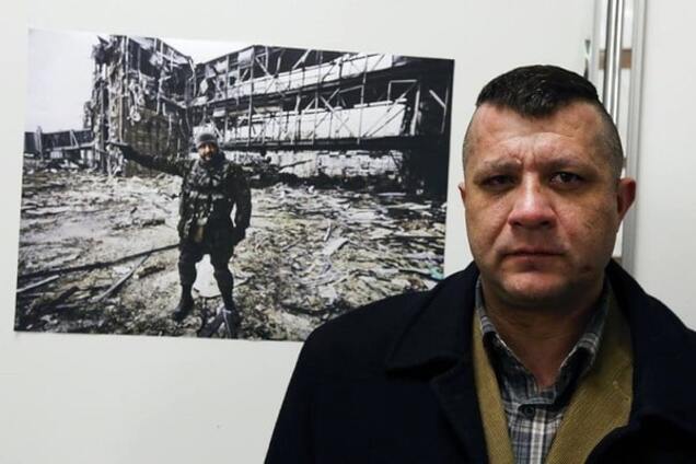 'Рахман' получил серьезные травмы кистей рук в плену