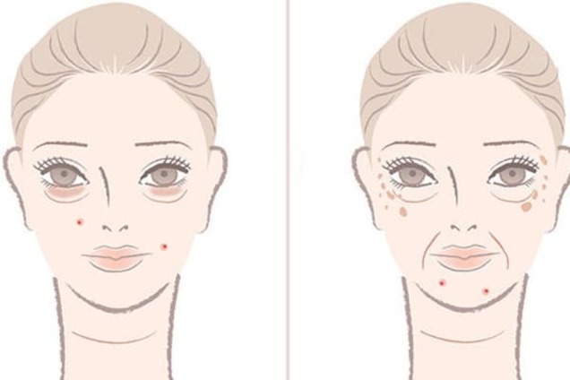 'Сахарное', 'винное' и 'молочное' лицо: какой продукт 'убивает' твою кожу