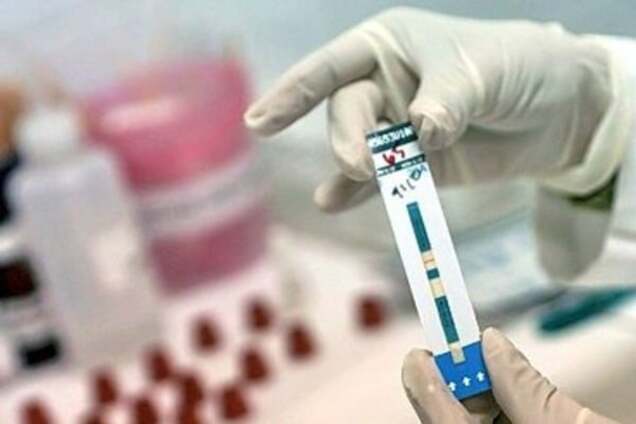 Врачи СПИД-центра в Славянске испортили тесты на 3 млн грн