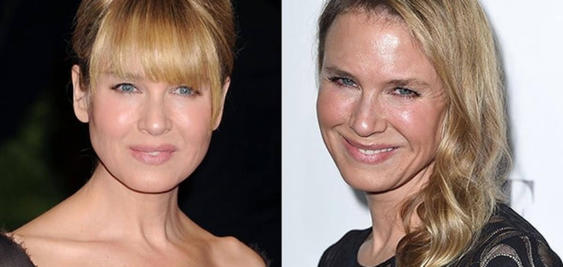 Рене Зеллвегер рассказала, как пережила последствия неудачной пластики