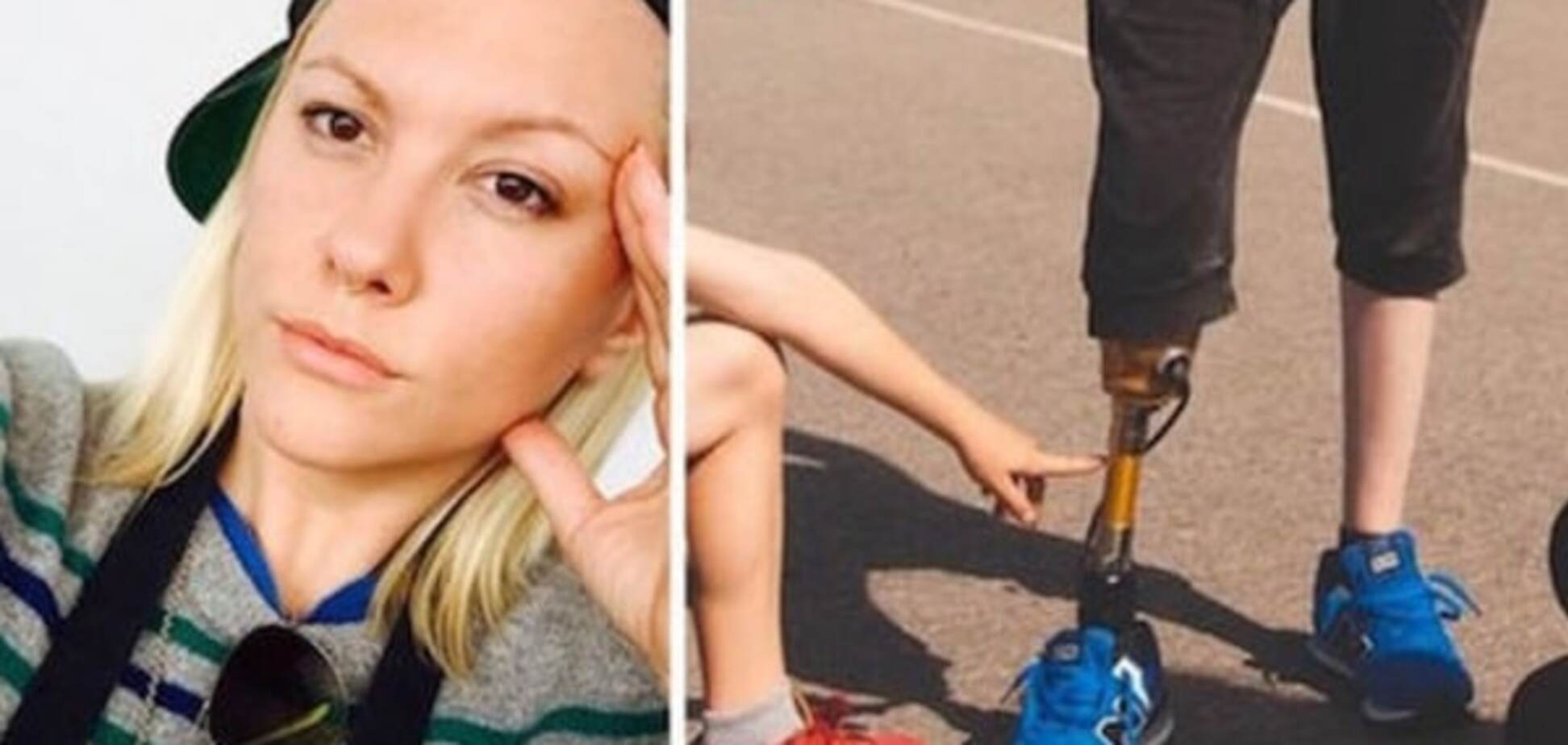 24-летняя модель стала инвалидом из-за использования тампонов