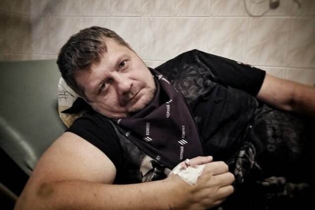 Врачи оставили Мосийчука в реанимации: обширная язва желудка и кровотечение