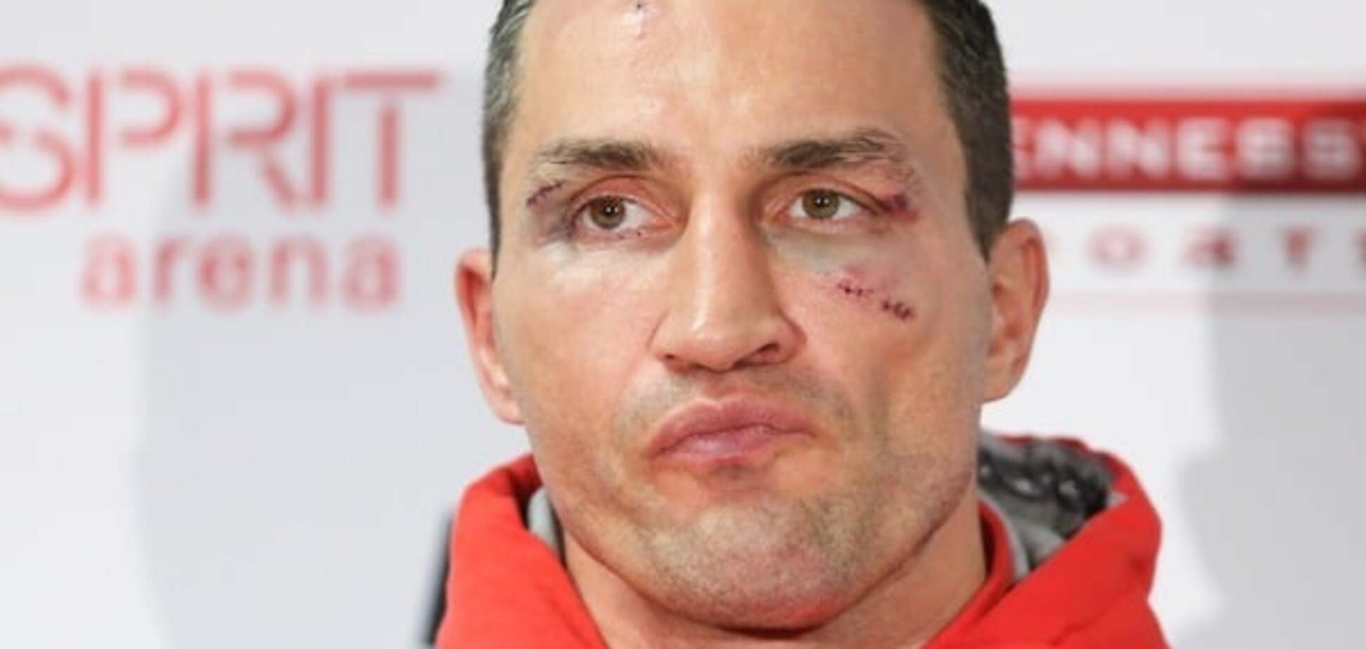 Кличко серьезно упал в рейтинге IBF