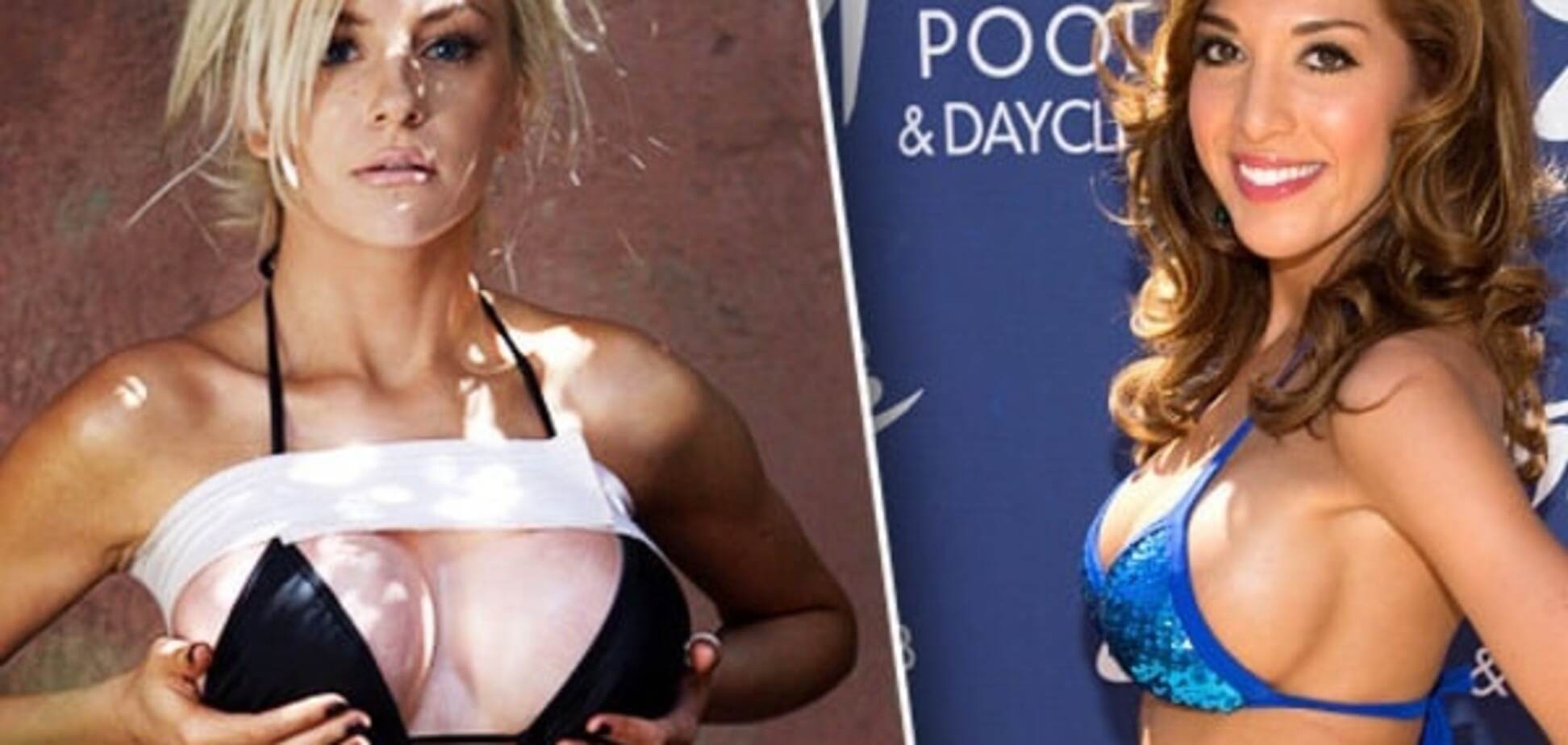 Зачем ждать: звезды, сделавшие пластику до 25 лет