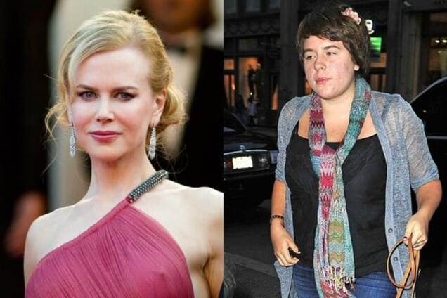 Гадкие утята: дети звезд, которым не повезло с внешностью