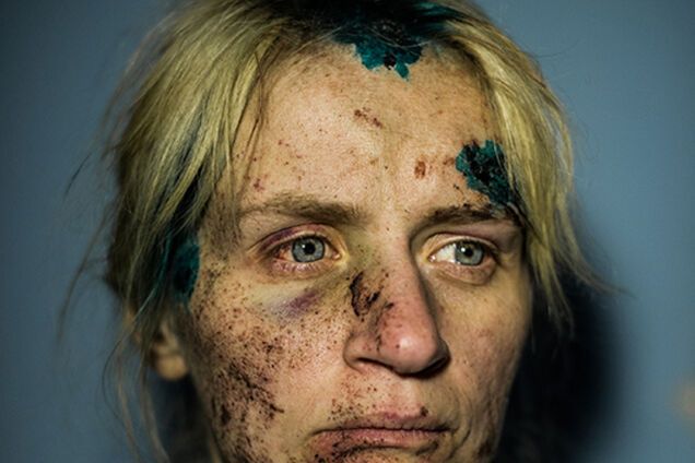 Портрет жінки, яка пережила обстріл в зоні АТО, переміг в міжнародному конкурсі 'Фото року'