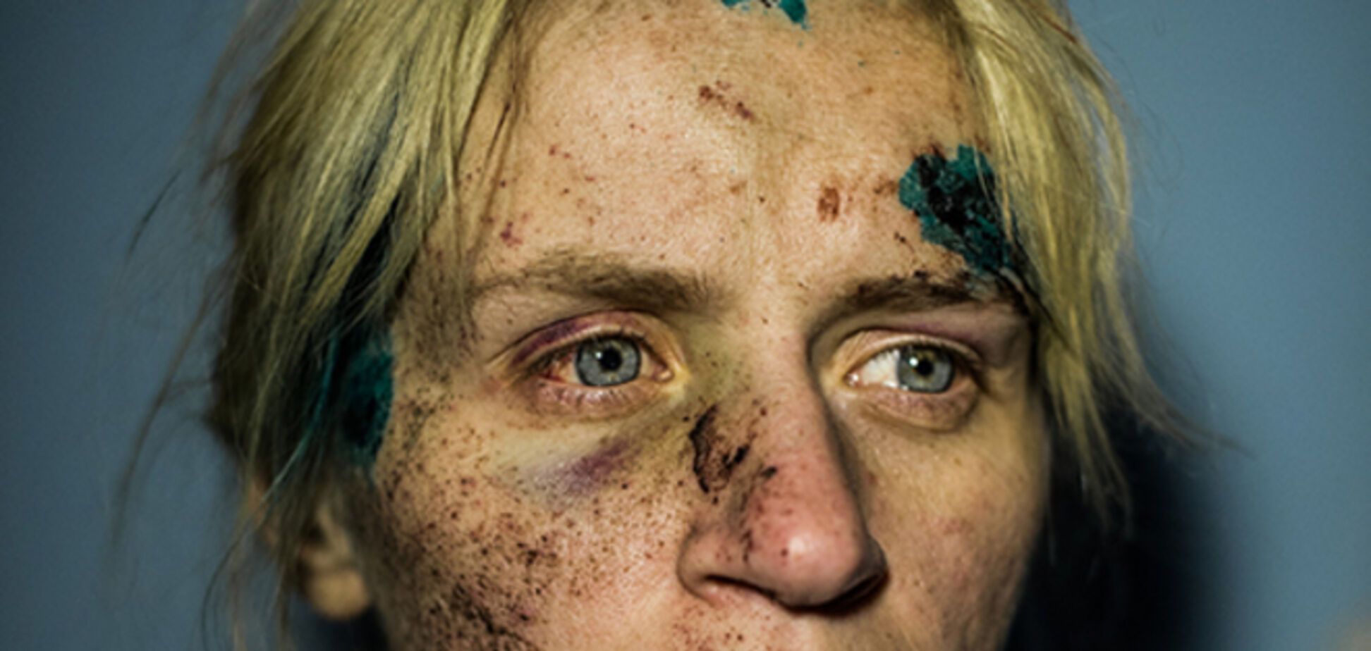 Портрет женщины, пережившей обстрел в зоне АТО, победил в международном конкурсе 'Фото года'