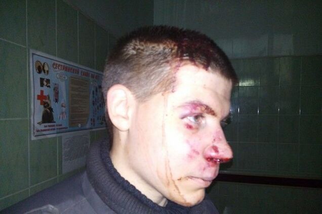 Одесситы поймали террориста из России - одного из трех избивших добровольца полка 'Азов'