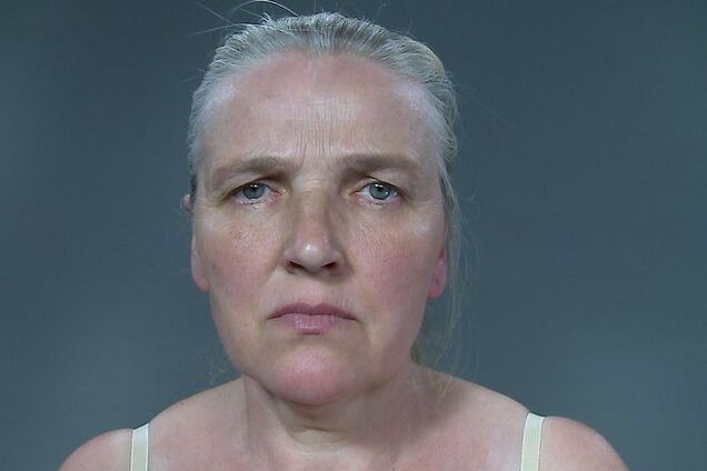 Проект 'Поверніть мені красу' врятував життя матері десятьох дітей