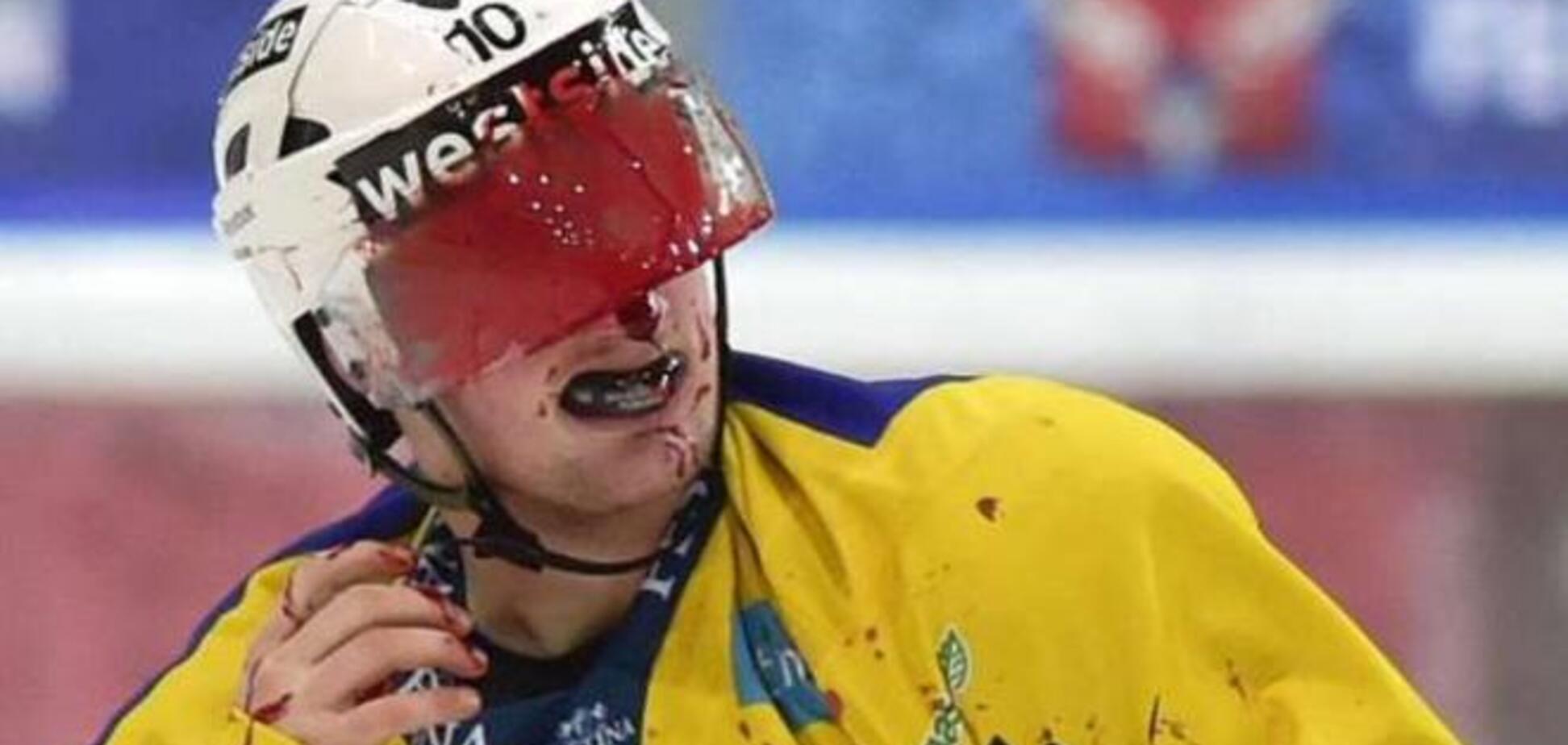 Хоккеисты устроили кровавое месиво на льду: видео боя