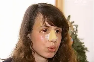 Татьяна Чорновол после покушения