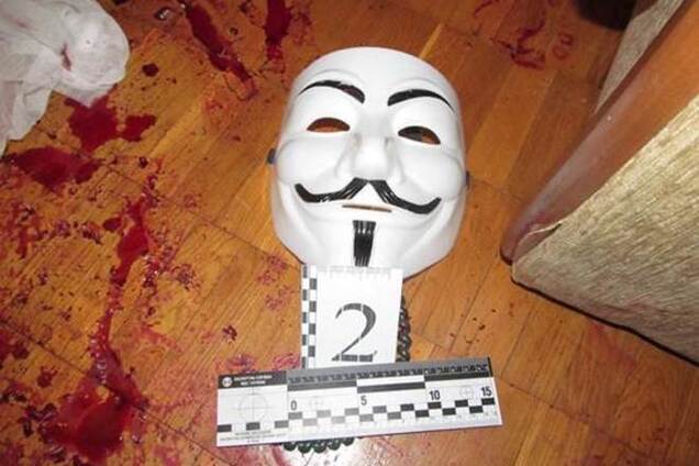 Дерзкое нападение в Киеве: неизвестный с ножом тяжело ранил 21-летнего парня