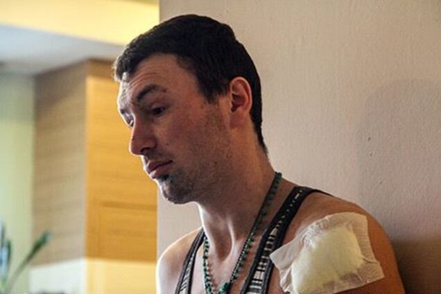 Удачная и плановая операция: боец рассказал, как раненый выходил из Дебальцево 5 дней по полям