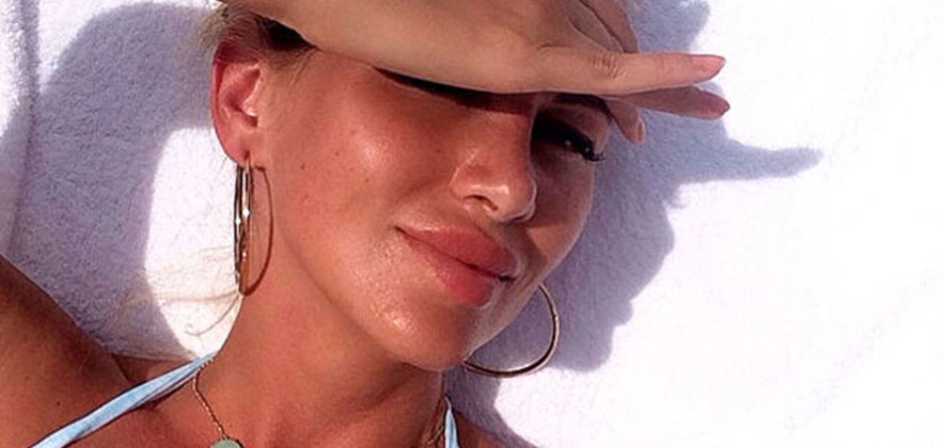 Виктория Лопырева напугала раздувшимися губами