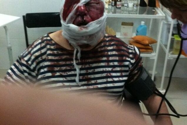 Неизвестные жестоко избили родителей депутата Харьковского горсовета