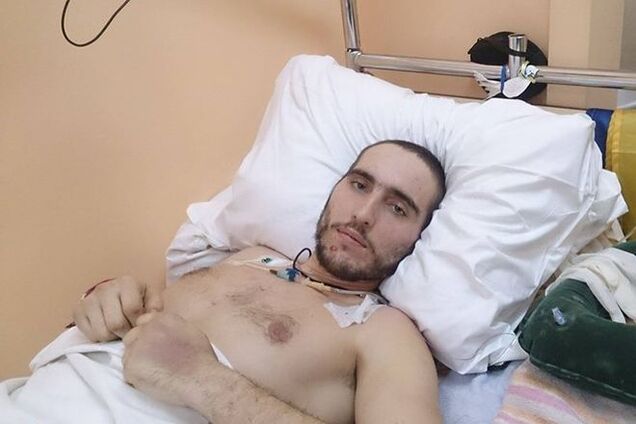 Раненый 'киборг': если хочешь выжить, страшно должно быть до паранойи