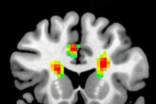 Ученые показали на снимке мозга, как выглядит любовь 
