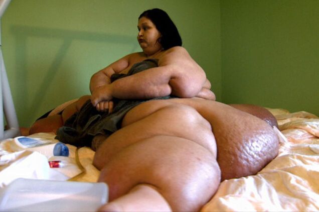 Девушка, которая похудела на 400 кг: никогда не теряйте надежду