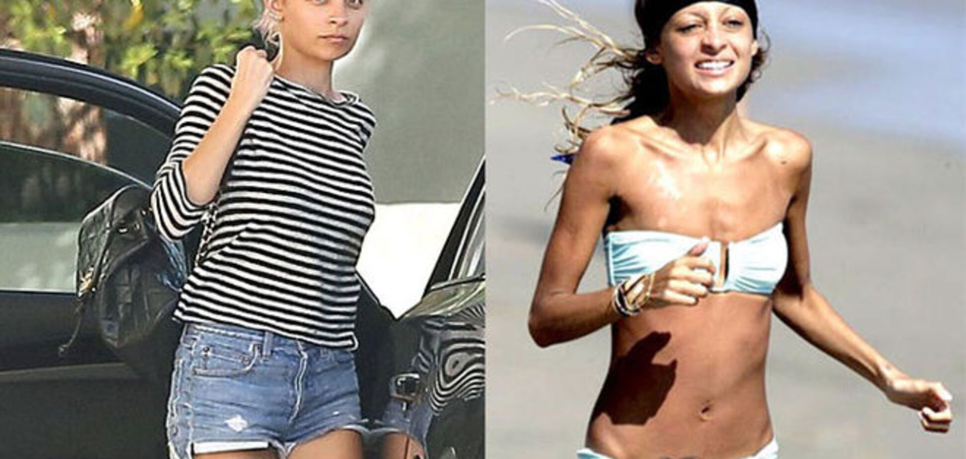 Исчезнувшие: красавицы, которых испортила худоба