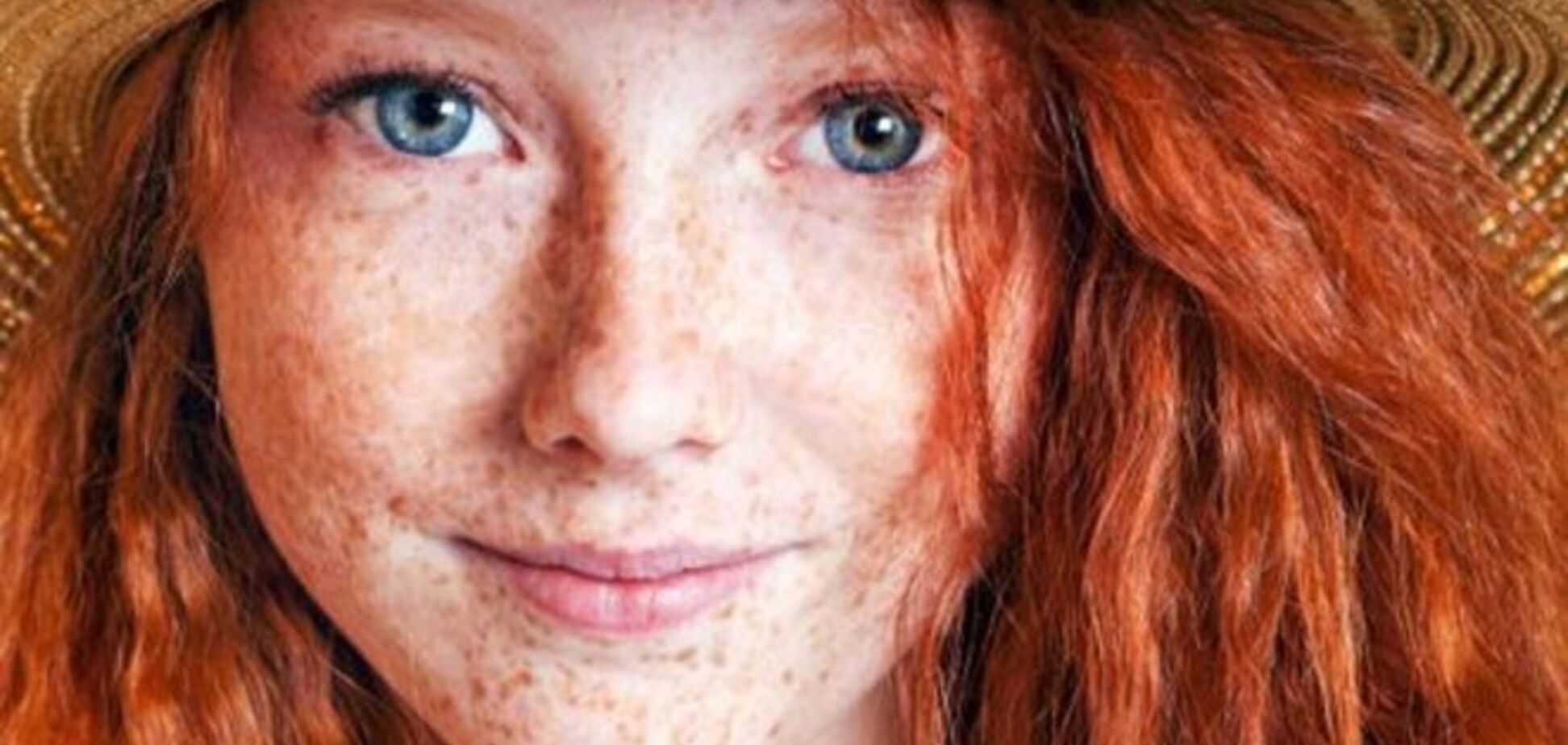 Способы избавления от веснушек на время и навсегда