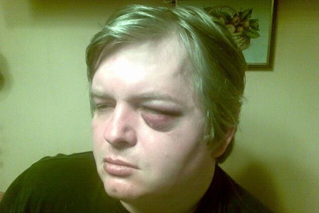 'Нашего друга избила охрана Богословской'. Музыканты написали открытое письмо Авакову