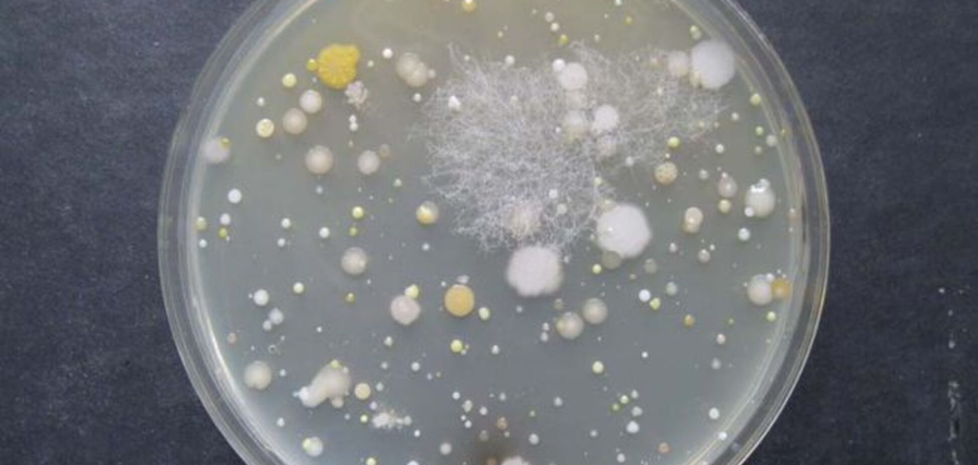Ученые обнаружили в домах целые колонии неизвестных бактерий