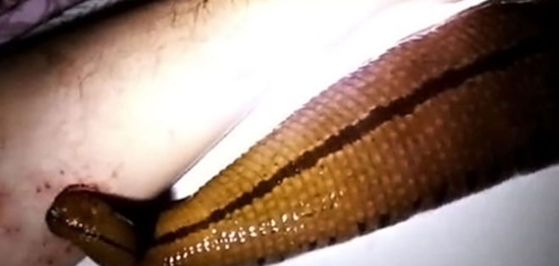 Мужчина завел гигантскую пиявку и кормит ее собственной рукой