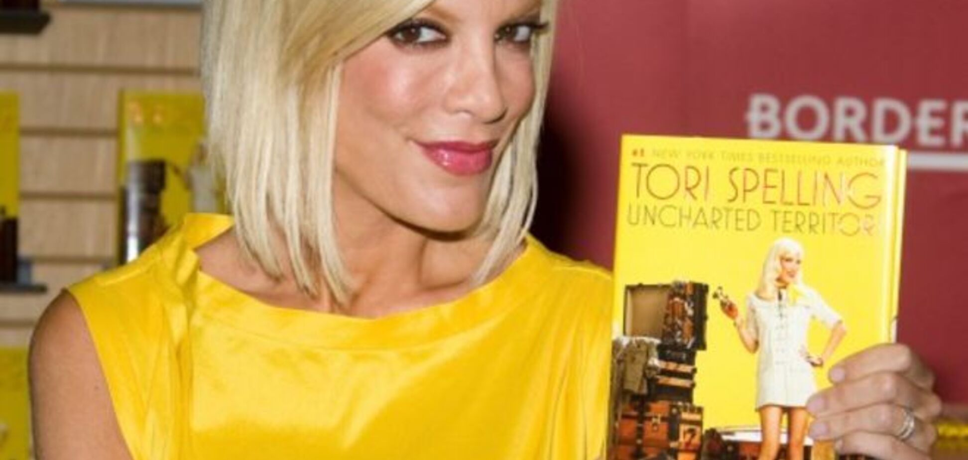 Голливудская звезда Тори Спеллинг сделала пересадку кожи