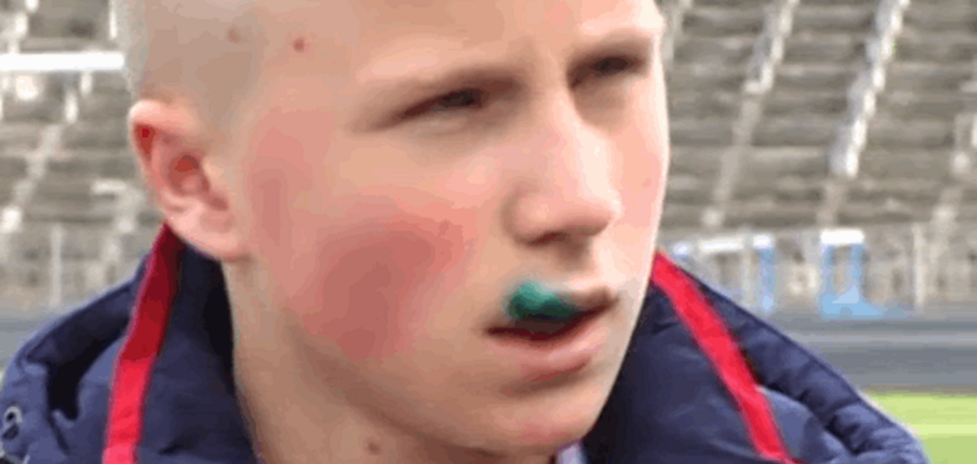 В Житомире в школе разъяренный мужчина ногами избил подростка