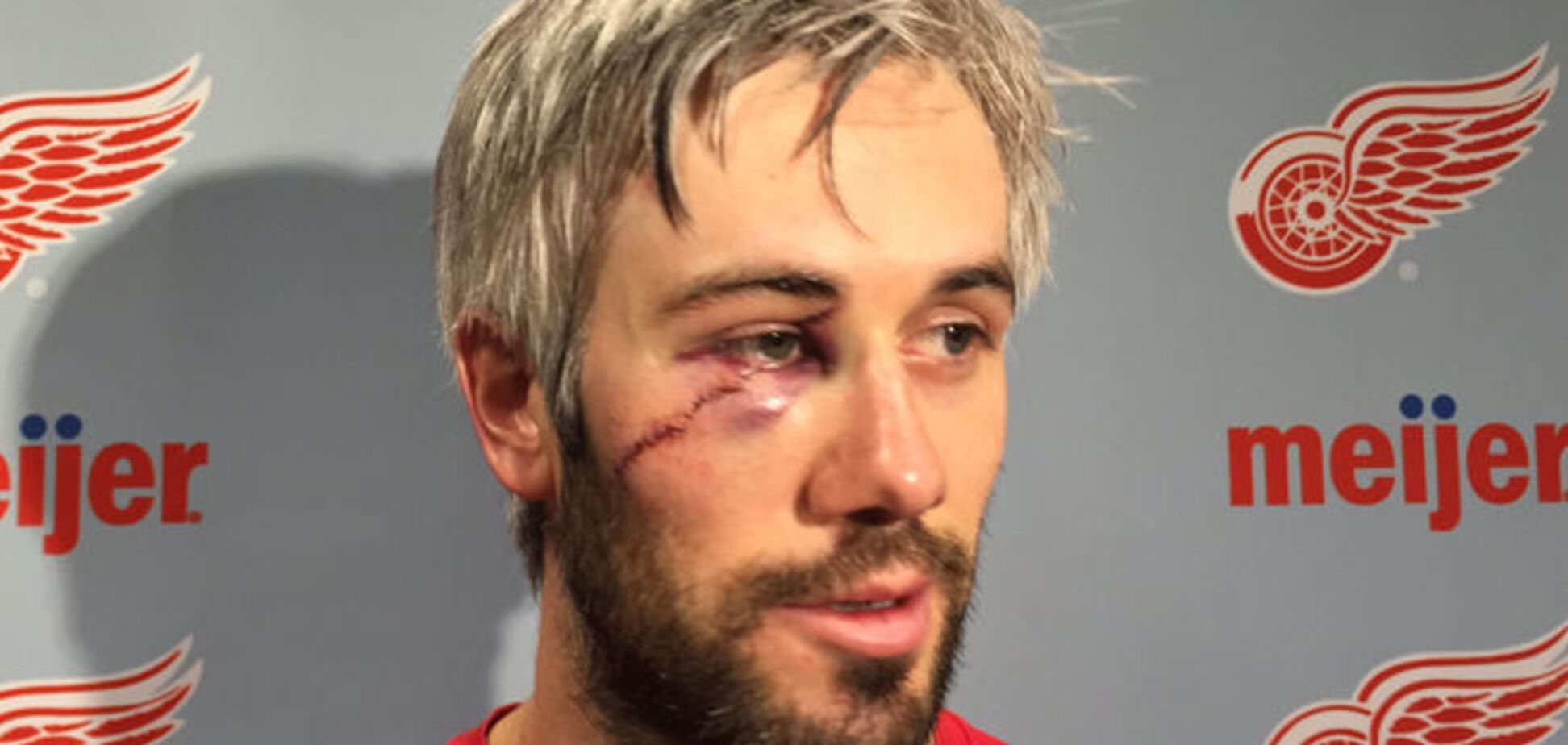 Хоккеисту наложили 60 швов после матча НХЛ