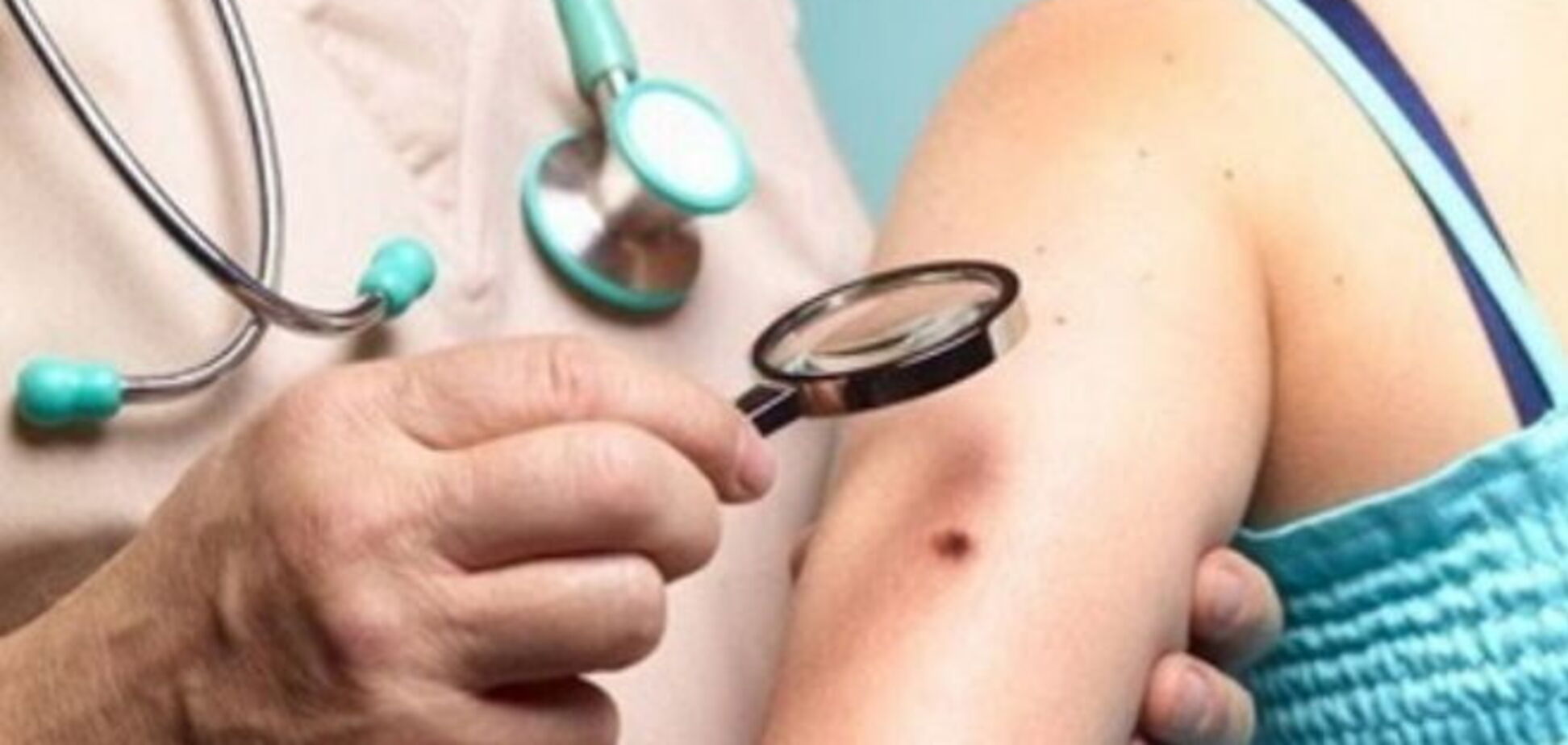 24 апреля по всей Украине можно будет бесплатно провериться на рак кожи