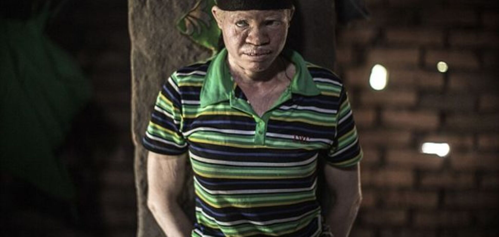 $75 тысяч за тело: в Африке колдуны объявили охоту на альбиносов