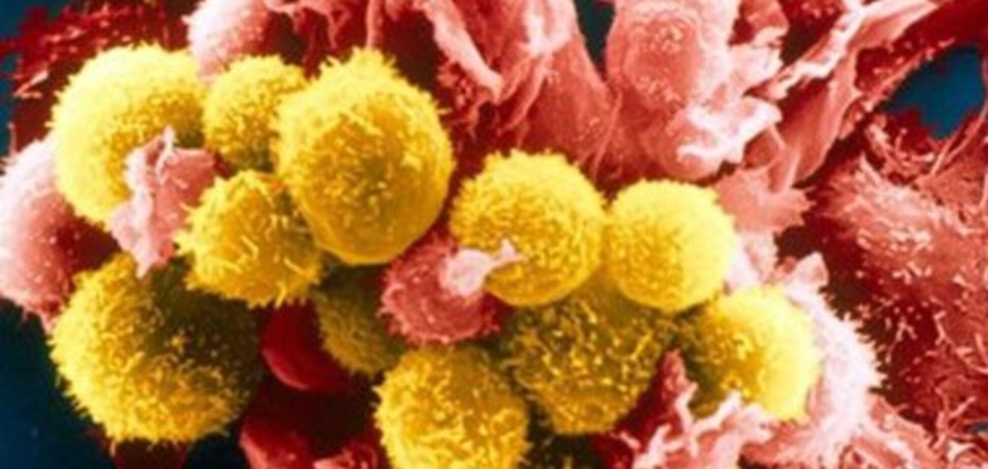 Учёные нашли способ превращения раковых клеток в здоровые