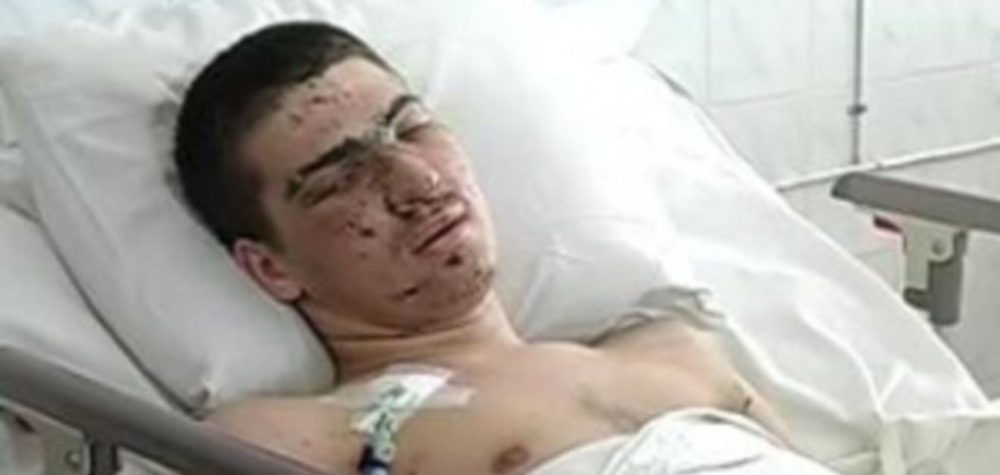 Під Миколаєвом лейтенант врятував 13 бійців, накривши собою гранату