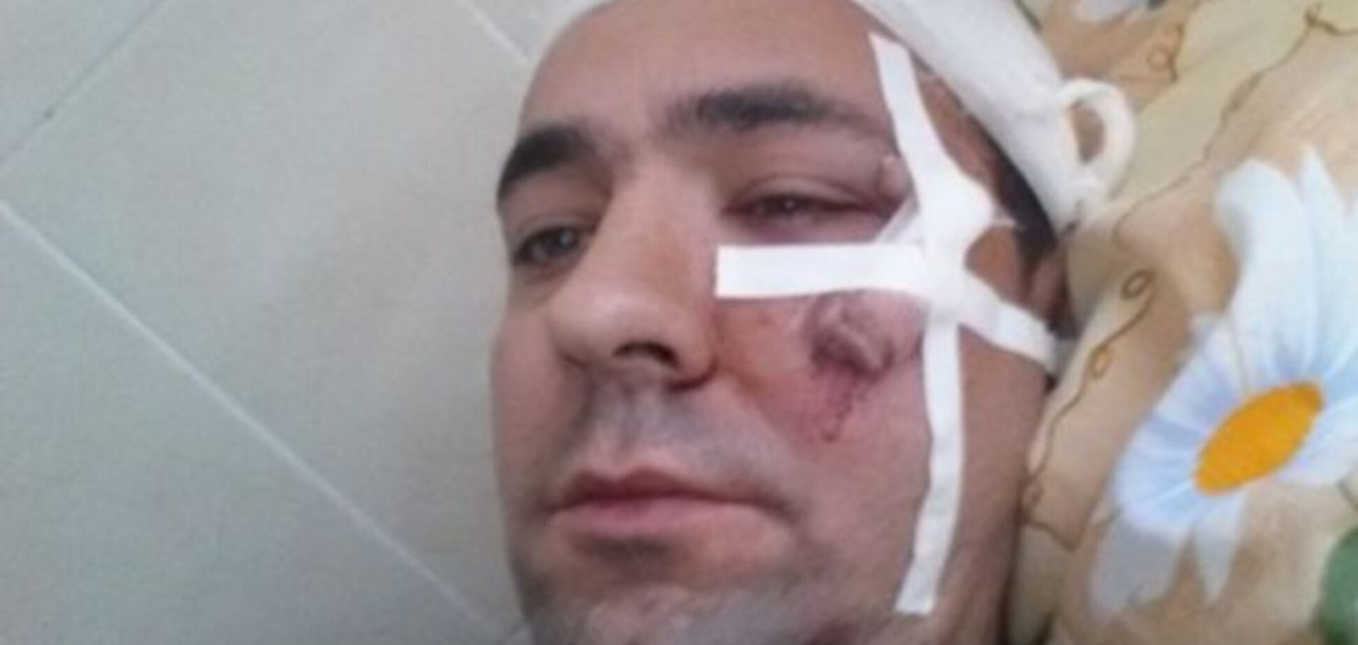 В Черновцах жестоко избили экс-депутата облсовета: фото с места событий