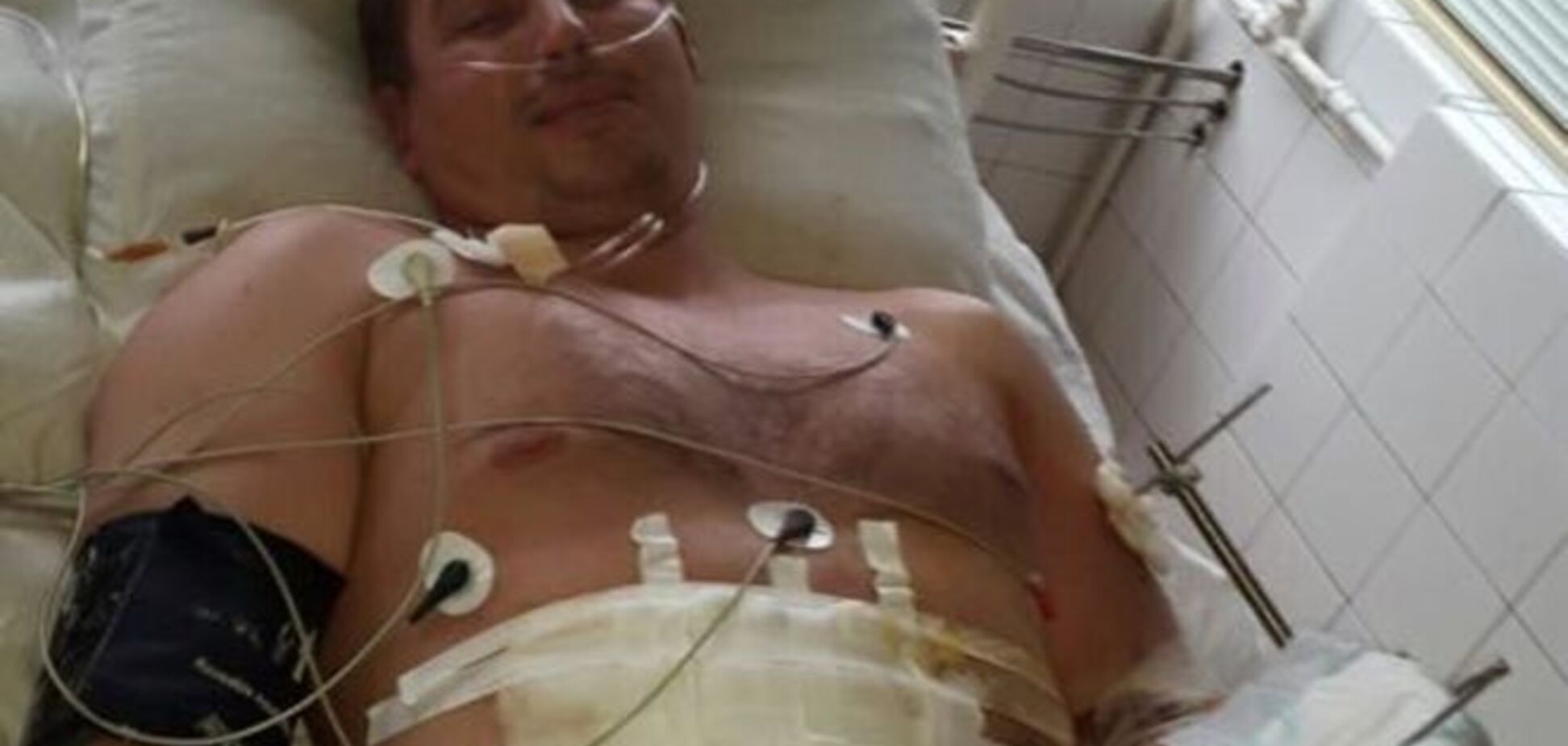 В Мариуполе в изоляторе держат бойца АТО с полуампутированной рукой: фотофакт