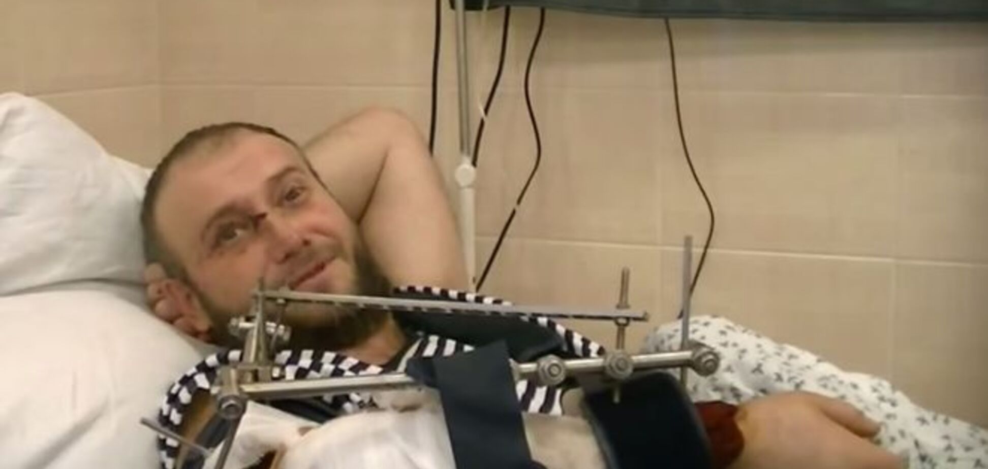 Состояние Яроша очень тяжелое, он ждет очередной операции - Рычкова