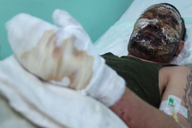 'Буря в Бурятии': история об обгоревшем танкисте всколыхнула россиян