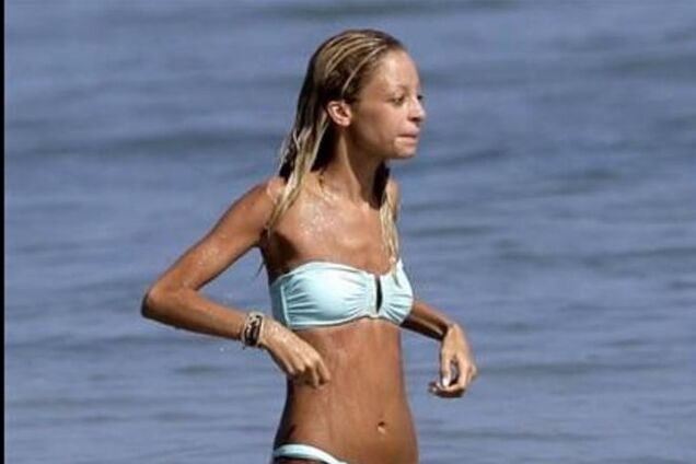 Во Франции запретили брать на работу анорексичных моделей