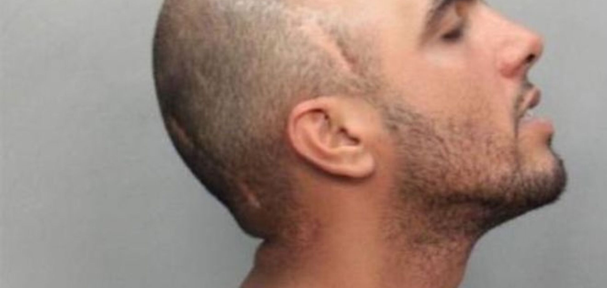 Выжить вопреки. Самые невероятные травмы, после которых выжил человек