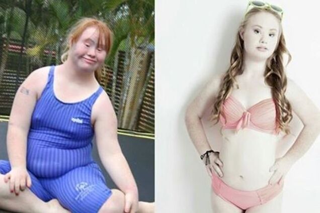 Невероятное перевоплощение: девушка с синдромом Дауна стала красавицей-моделью